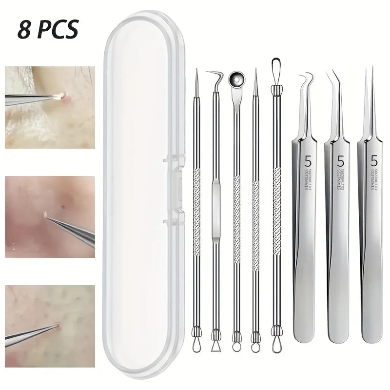 Luxury Blackhead Removal Tool Set