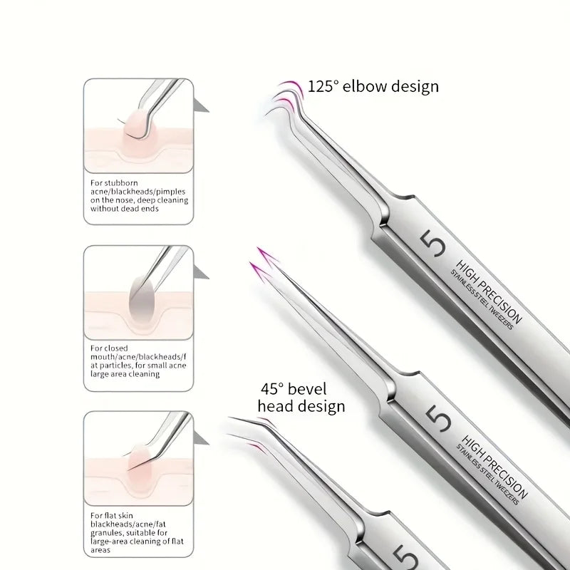 Luxury Blackhead Removal Tool Set